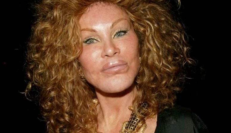 صورة ل المرأة القطة قبل خضوعها للتجميل... ملامح طبيعية جميلة