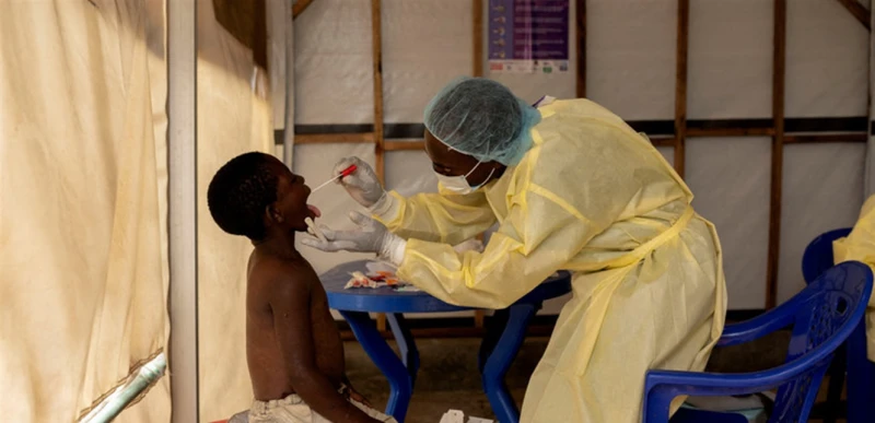 جدري القردة يثير قلق العالم مجددا صحة شاهد المقال التالي من صحافة لبنان عن جدري القردة يثير قلق العالم مجددا، يستمر انتشار فيروس جدري القردة في