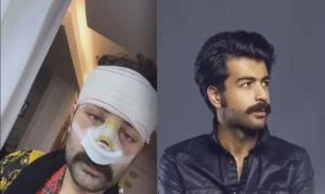 صوة عقيل الرئيسي قبل وبعد التجميل تتصدر الترند تعرف على التالي صوة عقيل الرئيسي قبل وبعد التجميل تتصدر الترند، وكالات السوسنةضجت وسائل التواصل