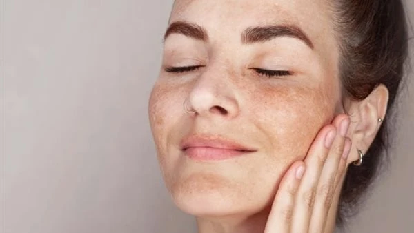 سبب صادم وراء تصبغ الوجه نتيجة التعرض لأشعة الشمس ماذا يحدث؟ الشمس رائعة للبشرة بعدة طرق فهي تزودها بفيتامين د، وتمنحك توهجا صحيا وتولد هرمونات تشعرك