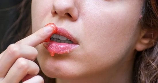 كل فتاة ولدت بلون شفاه معين، مناسبا لبشرتها، ولشكلها العام، لكن مع مرور الوقت والتغيرات المحيطة وتقلبات الجو، بالإضافة إلى تغيرات الهرمونات، قد يتغير