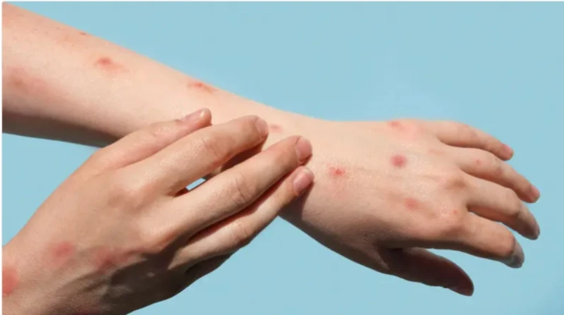 حالة طوارئ عامة.. جدري القردة يثير الرعب في أفريقيا تنتشر الأمراض والأوبئة بسرعة شديدة، تعطل العالم عن أداء وظائفه اليومية وقد سبق وشهدنا حاله الشلل التي أصابت العالم بعد انتشار في