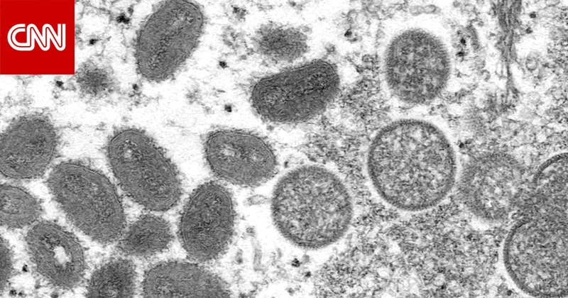 الصحة العالمية: جدري القرود مختلف عن فيروس كورونا.. ما الفرق بينهما؟ تكنولوجيا تكنولوجيا، الصحة العالمية جدري القرود مختلف عن فيروس كورونا ما الفرق
