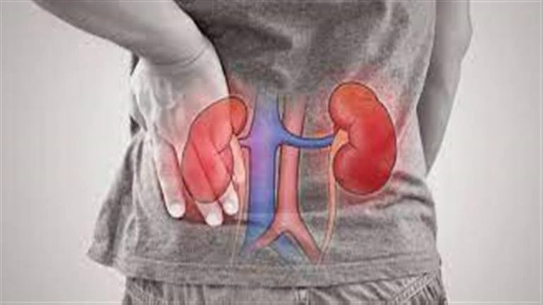 3 علامات صامتة تشير إلى مشكلة في الكلى.. اذهب للطبيب فورا لايف ستايل لايف ستايل، 3 علامات صامتة تشير إلى مشكلة في الكلى اذهب للطبيب فورا،04 00 م