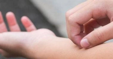 طرق منع انتشار عدوى السعفة.. أبرزها تجنب مشاركة الأدوات الشخصية صحة وطب صحة وطب، طرق منع انتشار عدوى السعفة أبرزها تجنب مشاركة الأدوات الشخصية،تعد