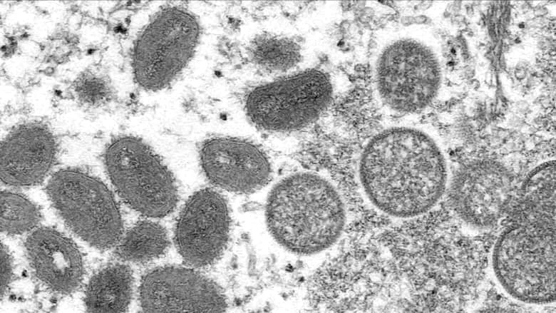 الصحة العالمية تطلق استراتيجية لوقف انتقال عدوى جدري القردة أطلقت منظمة الصحة العالمية إستراتيجية عالمية للاستجابة ووقف انتقال عدوى جدري القردة من