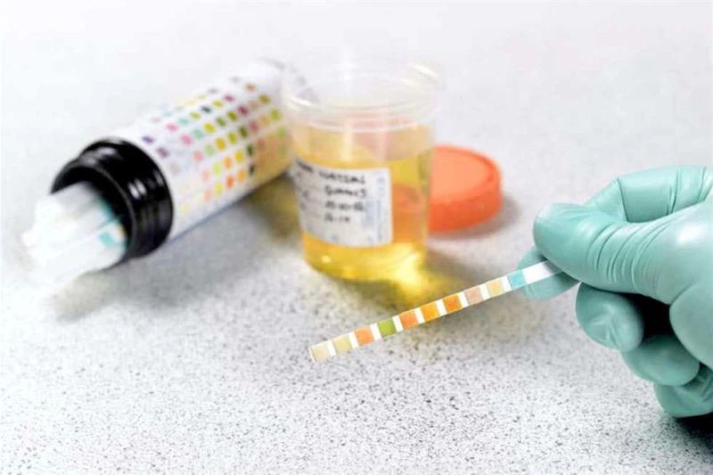 هل يطبق قانون تعاطي المخدرات على الموظفين أصحاب الأمراض المزمنة؟.. العدل تجيب علقت وزارة العدل على سؤال برلماني مقدم من المهندس إيهاب منصور، رئيس