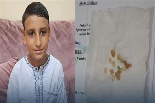 والدة طفل كفر الشيخ: ابني يتبول أحجارا كريمة وألماس.. ولا أروج إشاعاتأثارت تصريحات والدة طفل عن تبول طفلها أحجارا كريمة وألماس الجدل على مواقع