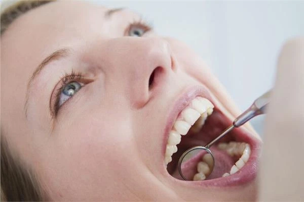 لون فمك.. كيف يمكن أن يكشف عن حالات صحية خطيرة متفرقات شاهد المقال التالي من صحافة مصر عن لون فمك كيف يمكن أن يكشف عن حالات صحية خطيرة، لون فمك كيف