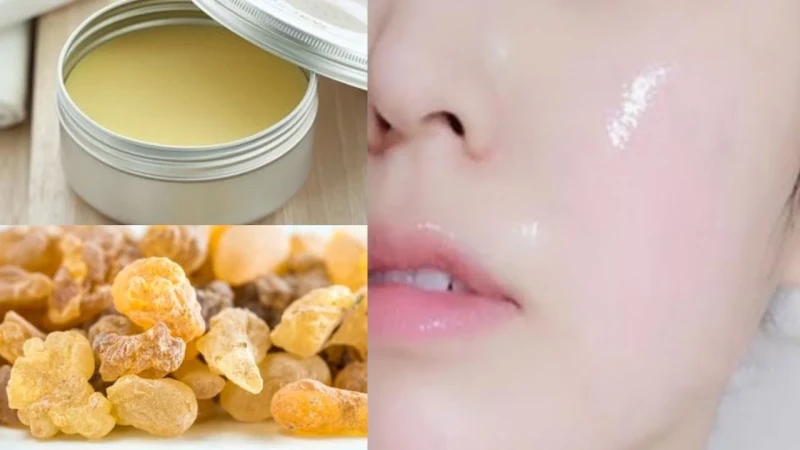 كولاجين لبان الدكر لشد التجاعيد هتبهري الجميعتواجه العديد من النساء مشكلة التجاعيد، مما يسبب لهن إزعاجا شديدا، في محاولة للتغلب على هذه المشكلة، تلجأ