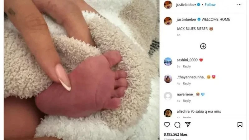جاستن بيبر يرزق بطفل.. وصورته تحصد 8 ملايين إعجاب افاق عربية - أعلن نجم البوب الكندي جاستن بيبر، أمس الجمعة، ولادة جاك بلوز، نجله من عارضة الأزياء الأميركية هيلي بيبر، في منشور عبر