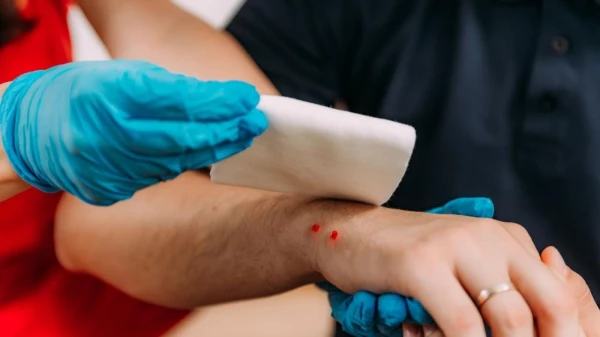 الصحة العالمية: شخص يموت من لدغة ثعبان كل 4 دقائق لايف ستايل قالت منظمة الصحة العالمية: إن شخصا واحدا يموت من لدغة ثعبان كل 4 إلى 6 دقائق حول العالم،