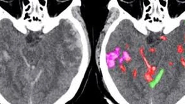 انطلاق الدورة الثامنة للمؤتمر العربي الإفريقي الدولي للأورام بصبغة تكنولوجية عقدت في القاهرة، تحت رعاية وزير الصحة والسكان، فعاليات الدورة الثامنة للمؤتمر العربي الإفريقي الدولي لل