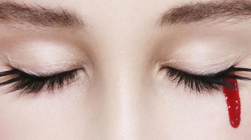 يبكي دما أثناء التبول.. طفل هندي يثير حيرة الأطباء أثار طفل هندي يعيش في مدينة بنجالور حيرة الأطباء بسبب حالة نادرة وغامضة تجعله يبكي دما بشكل