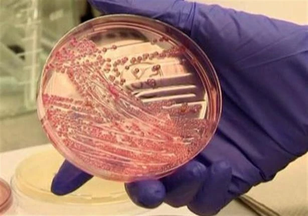 دراسة: البكتيريا المقاومة للأدوية قد تقضي على 39 مليون شخص لايف ستايل 04:00 ص الأربعاء 18 سبتمبر 2024 هل تصدق أن عدوا دقيقا لا يرى بالعين المجردة قد يشكل تهديدا وجوديا للبشرية؟ نعم