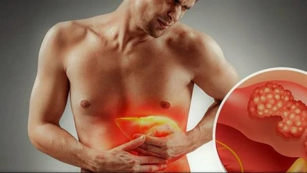 احم كبدك .. 15 سببا تؤدي لتلفهيعد تليف الكبد من الحالات الصحية شديدة الخطورة حيث تؤثر على كفاءة الجسم وتسبب مضاعفات عديدة قد تصل للوفاة لذا من المهم تجنب أسبابه.الأسباب:توجد مجموعة