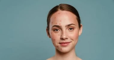 7 علامات على وجهك تشير إلى عدم توازن الهرمونات صحة وطب الهرمونات هي مواد تنظيمية حيوية تتحكم في وظائف مختلفة في أجسامنا، بما في ذلك التمثيل الغذائي والمزاج وصحة الجلد، وهى بمثابة ا