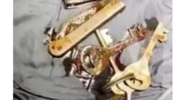 جراح يستخرج مفاتيح وقاطع أظافر وسكين من معدة هندى بسبب السوشيال ميديا صحة وطب أصيب الأطباء فى الهند بالذهول بعد إزالة مفاتيح وقاطع أظافر وسكين من معدة شاب، قيل إنه فى أوائل العشرين