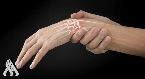 أطباء يوضحون أعراض ارتفاع وانخفاض مستوى الكالسيوم في الجسم منوعات متابعة-واعيعتبر الكالسيوم، أحد العناصر الضرورية للجسم لأن له مجموعة متنوعة من المهام: يحافظ على بنية العظام والأسن