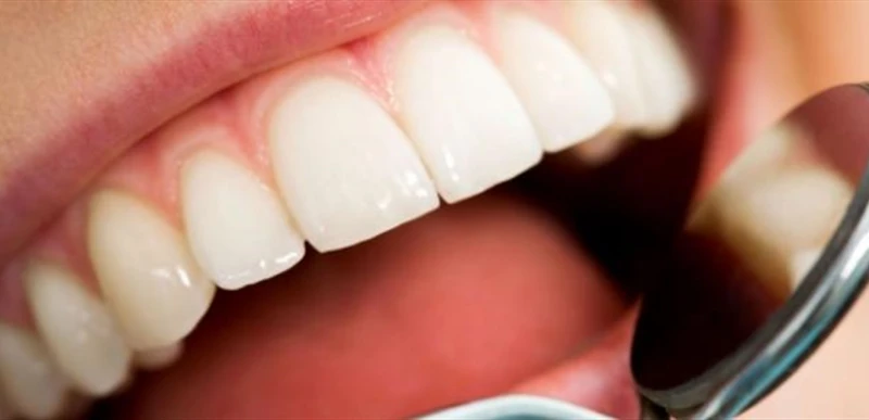 ما هي أسباب تخلخل الأسنان؟ صحة يعتبر تخلخل الأسنان أحد الأمور المهمة التي تؤثر سلبا على صحة الفم والفكين. وعن الموضوع قالت الطبيبة وأخصائية تقويم الأسنان الروسية، ماريا ميخائلوفا:ت