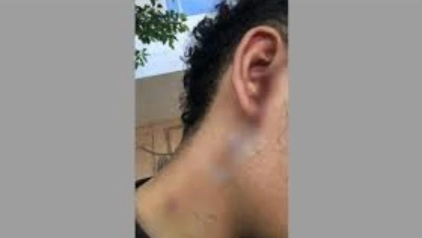 لرفضه بيع المخدرات.. عاطل يقطع أذن شاب في الطالبية أمام منزله قطع عاطل أذن شاب بسلاح أبيض بمنطقة الطالبية بمحافظة الجيزة، بسبب رفض المجني عليه بيع