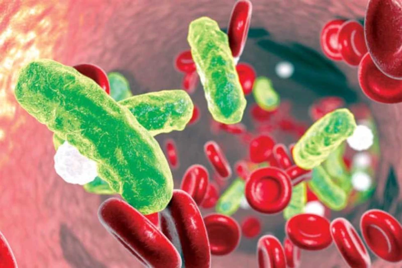 احذرها.. أسباب وأعراض تسمم الدم يحدث تسمم الدم أو ما يطلق علية اسم الإنتان بسبب التهابات بكتيرية، وقدينجم عن حالات عدوى أخرى مثل: الفيروسات أو التطفيليات أو الفطريات، ويتطلب علاج ت