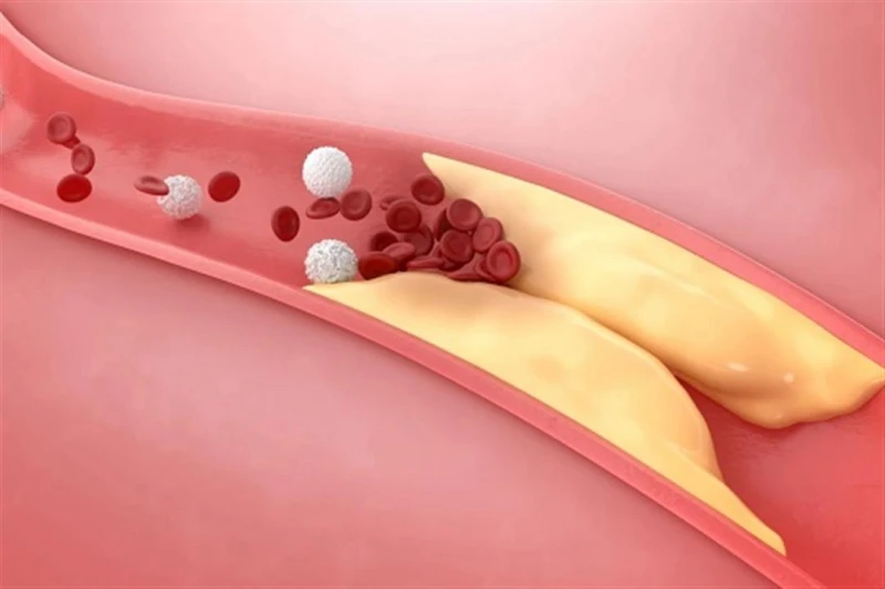 احذر.. جزء في الدجاج يرفع نسبة الكوليسترول بالدم لايف ستايل كتبت- شيماء مرسي ليست كل أجزاء الدجاج منخفضة الكوليسترول، لهذا السبب يجب اختيار القطعة