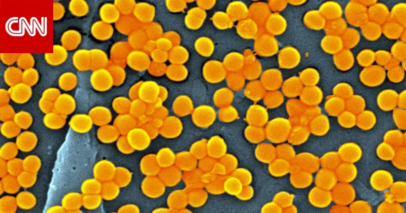 دراسة: الجراثيم المقاومة للمضادات الحيوية تهدد حياة 40 مليون شخص بحلول عام 2050 تكنولوجيا دبي، الإمارات العربية المتحدة () -- تشير دراسة جديدة إلى أن