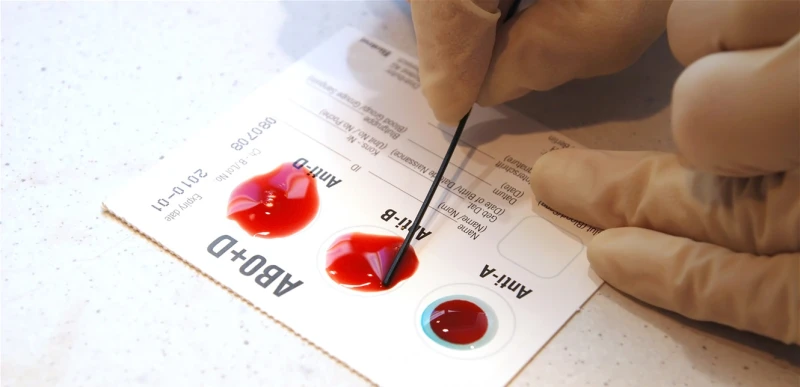 تأثيرات مدمرة على المرضى... علماء يكتشفون فصيلة دم جديدة صحة عندما تم أخذ عينة من دم امرأة حامل في عام 1972، اكتشف الأطباء حينها أن العينة تفتقر بشكل