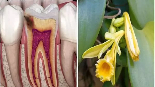 احترس من أسباب آلام الأسنان.. حيل سريعة لتخفيفهاآلام الأسنان يمكن أن تكون مزعجة وقد تشير إلى مشكلة طبية تحتاج إلى عناية واكتشاف بعض المعلومات