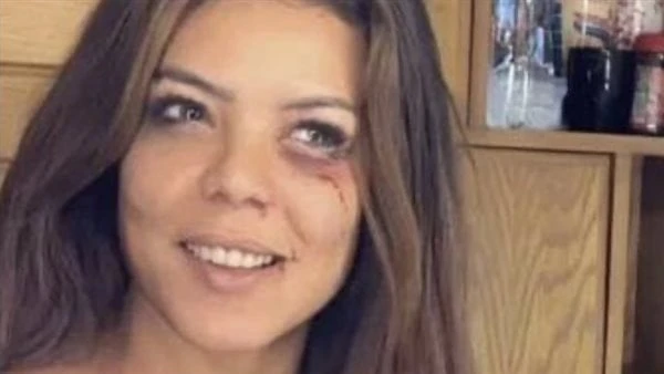 إصابة ناهد السباعي بكدمات وجروح بالغة بسبب بنات الباشاشاركت الفنانة ناهد السباعي، جمهورها ومتابعيها، بصورة لأحدث ظهور لها، عبر حسابها الرسمي على موقع