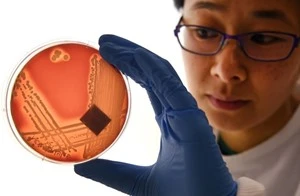 اكتشاف خلية جديدة بوظائف متعلقة الشفاء تم التنبؤ بها منذ 100 عام عربي21 لايت اكتشف باحثون في أستراليا نوعا جديدا تماما من الخلايا ما يشكل قفزة واسعة في إمكانية فهم كيفية شفاء جسم ا