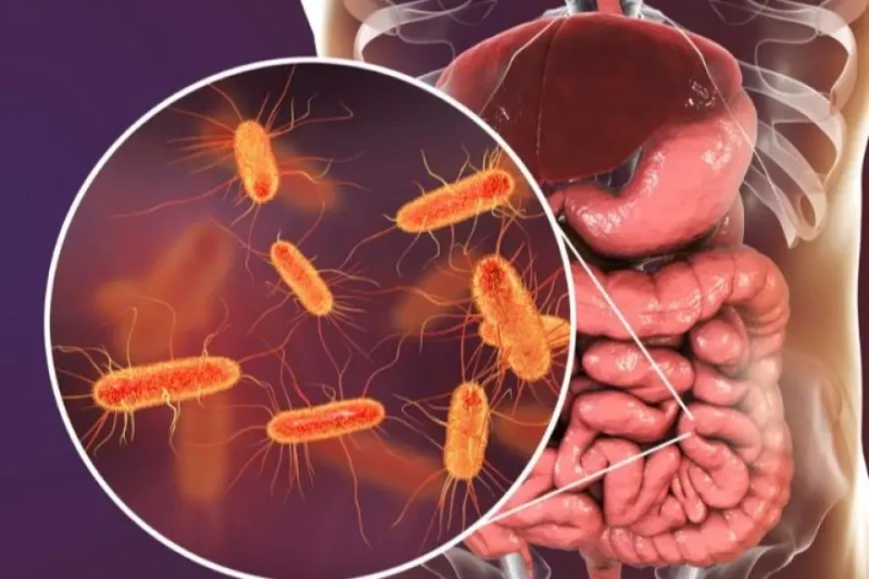 بعد تسببها في إصابة أهالي أسوان.. ما هي أعراض البكتيريا الإشريكية القولونية؟أكد الدكتور خالد عبد الغفار، نائب رئيس الوزراء للتنمية الصحية ووزير الصحة