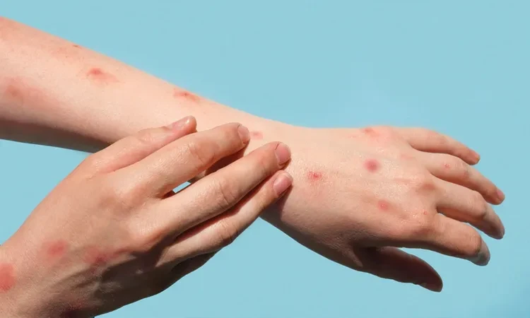 الأردن يبدأ حملة تقصي بعد اكتشاف مصاب بجدري القرود صحة أطلقت الأردن، حملة تقصى عدوى جدري القرود، بعد اكتشاف إصابة بالفيروس داخل المملكة. وقال رئيس