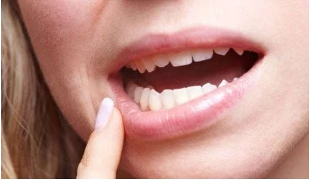 تفسير حلم سقوط الأسنان ل ابن سيرين منوعات الاسبوع تفسير حلم سقوط الأسنان.. يشغل بال الكثير حول تفسير الأحلام لمعرفة دلالات كل حلم إذ كان يدل على