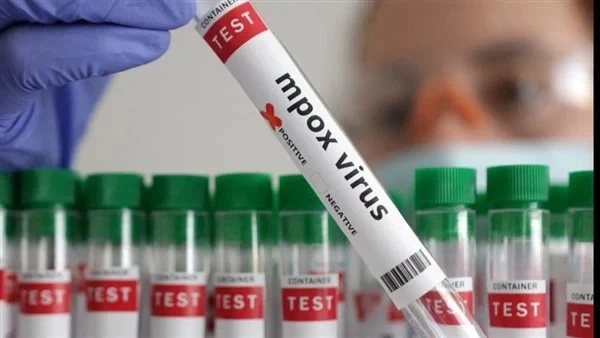 أول دولة عربية تعلن عن تسجيل إصابة بجدري القرود وتضعها بالعزلتسجيل إصابة بجدري القرود أفادت وكالة الأنباء الأردنية اليوم الاثنين، بأن وزارة الصحة قد