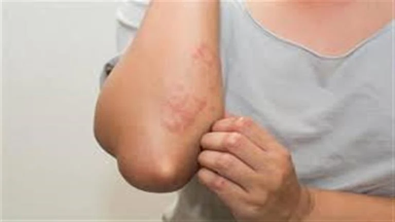 ما أسباب ظهور البقع على الجلد؟ لايف ستايل 11:01 ص الإثنين 02 سبتمبر 2024 ظهور البقع على الجلد له أسباب مختلفة، بما فيها تناول أطعمة معينة، مثل