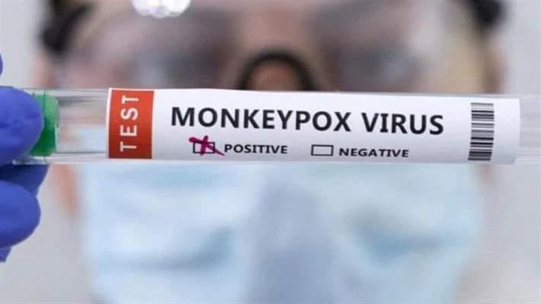 الأمم المتحدة للطفولة تطرح مناقصة لتأمين لقاحات ضد جدري القردة لايف ستايل 04:01 ص الإثنين 02 سبتمبر 2024 - رويترز طرحت منظمة الأمم المتحدة للطفولة