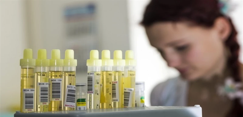 تحليل بول رخيص يكشف السرطان! صحة ابتكر العلماء الروس كاشفا جديدا لاختبار البول بسرعة بحثا عن اختلال توازن الأحماض الأمينية.وقام العلماء من جامعة كوبان الحكومية الروسية مع زملائهم م