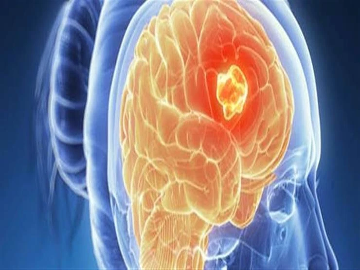 في ساعة فقط.. باحثون يبتكرون فحص دم لتشخيص سرطان الدماغ لايف ستايل 01:01 ص الإثنين 02 سبتمبر 2024 نجح باحثون أمريكيون من جامعة نوتردام في ابتكار فحص دم سريع لتشخيص سرطان الدماغ، با