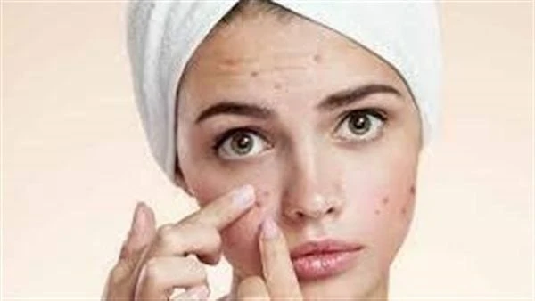 احذر.. نقص هذا الفيتامين في الجسم يصيبك بمعظم مشاكل الجلدالأشخاص الذين يعانون من نقص فيتامين ب12 قد يعانون من تفاقم مرض الصدفية، مما يؤدي إلى ظهور