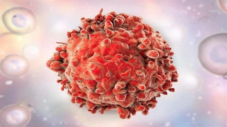 علامات خطيرة تكشف إصابتك بالسرطان.. احذرها لايف ستايل كتبت- آلاء نبيل: عند الإصابة بمرض خطير، تبدأ العلامات في الظهور على الوجه، مما يساعد الشخص على تلقي العلاج المبكر، و من بين هذ