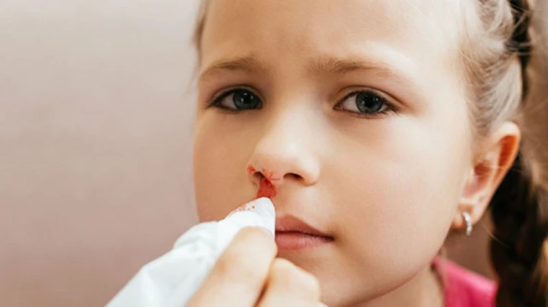 خاص ل اليوم.. استشاري يوجه نصائح مهمة للطلاب المصابين ب الرعاف الحياة نصح استشاري طب وجراحة الأنف والأذن والحنجرة الدكتور عبدالمنعم حسن الشيخ، طلبة