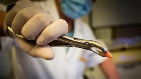 رجل يفقد حياته بعد إزالة 23 سنا في يوم واحد.. ما السبب؟نشرت فتاة على مواقع التواصل الإجتماعي بأن والدها توفي بنوبة قلبية بعدما قام بخلع 23 سنا،