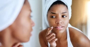 الدمامل مشكلة جلدية تعنى التهاب الجسم.. اعرف طرق العلاج صحة وطب الدمامل عبارة عن عدوى جلدية مؤلمة تتسبب في ظهور بثور مليئة بالصديد، ويجب علاجها علي الفور تجنبا للتعرض لمشاكل صحية خ