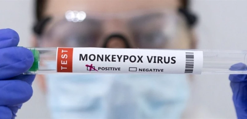 إرتفاع غير مقبول بوفيات جدري القرود.. وهل تنقل المرأة الحامل المرض إلى طفلها؟ صحة إرتفاع غير مقبول بوفيات جدري القرود.. وهل تنقل المرأة الحامل المرض إلى طفلها؟ اقرأ على الموقع الرس