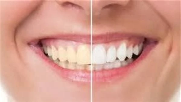 لابتسامة ناصعة البياض.. نصائح فعالة للتخلصص من اصفرار الأسنانأحيانا نعاني من اصفرار الأسنان، والتي تؤثر على الشكل وتجعلنا نشعر بالخجل من الضحك