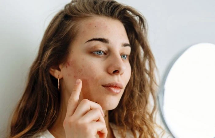 كيف يؤثر كل من الاكتئاب والقلق في البشرة بوصفهما أكثر الاضطرابات النفسية شيوعا في الولايات المتحدة الأمريكية؟ قد يقدم مجال جديد مختص في علم الأمراض الجلدية والنفسية جوابا على السؤا