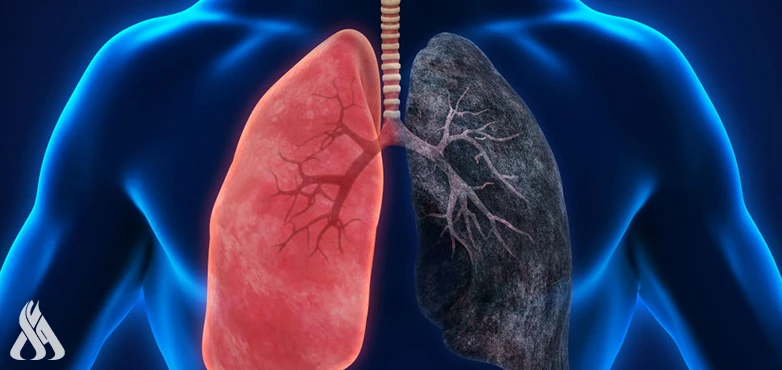 تطوير برمجيات لتشخيص أمراض الرئة والأوعية الدموية منوعات منابعة-واعأعلنت جامعة العلوم الكهروتقنية في بطرسبورغ عن تطوير برمجيات جديدة تساعد في تشخيص
