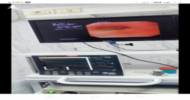 بشرى سارة لأهالي كفر الدوار والمراكز المجاورة .. متابعه عبدالله محمد عبدالله بشرى سارة لأهالي كفر الدوار والمراكز المجاورة استئناف العمل بوحدة مناظير